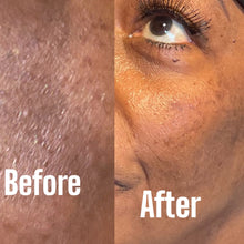Load image into Gallery viewer, At 60 plus her skin was becoming dark due to kidney issues and using coffee honey soap on her skin has made a difference in appearance, color and texture