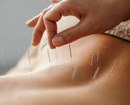 Acupuncture: A Comprehensive Release Action Plan